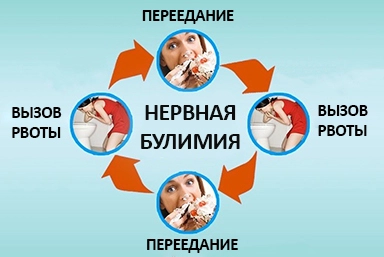 Лечение булимии в Туринске